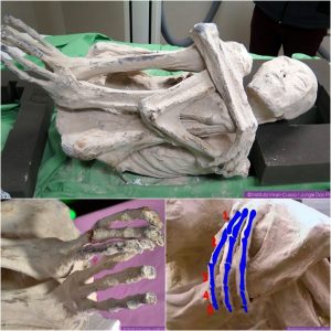 BREAKING NEWS: Unveiling the Mystery: DNA Analysis Hints at a Potential New Human Species in Peruvian Three-Fingered Alien Corpses