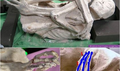 BREAKING NEWS: Unveiling the Mystery: DNA Analysis Hints at a Potential New Human Species in Peruvian Three-Fingered Alien Corpses